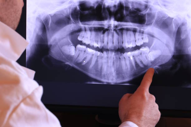 Best Emergency Root Canal Therapy in Maineville, OH