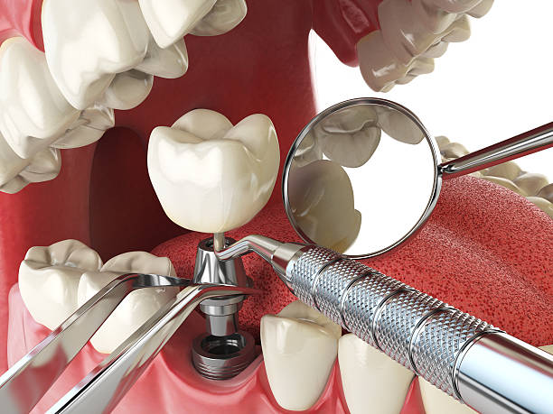 Best Weekend Emergency Dental Services in Maineville, OH