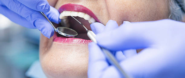Best Broken or Chipped Tooth Repair in Maineville, OH