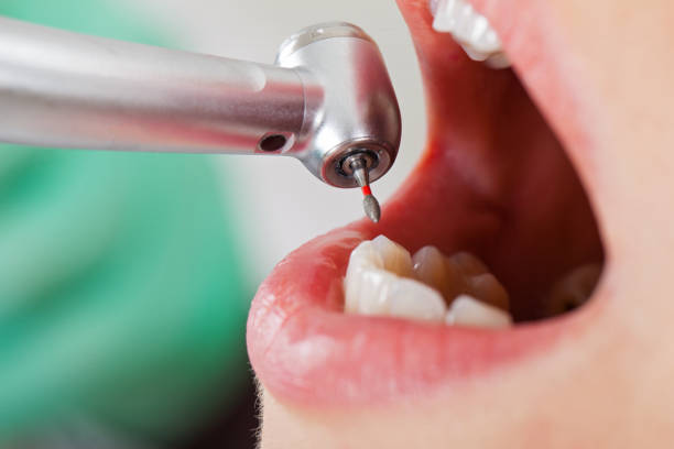 Best Dental Abscess Treatment in Maineville, OH